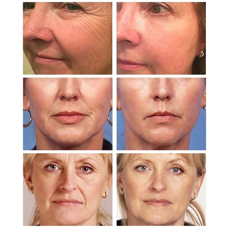 Anti Aging Face Cream Wrinkle Remover Creams in New York